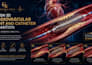 design 3d cardiovascular stent  and catheter  animation